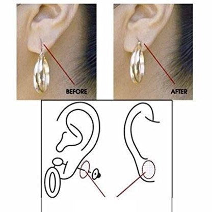 Ear lobe support